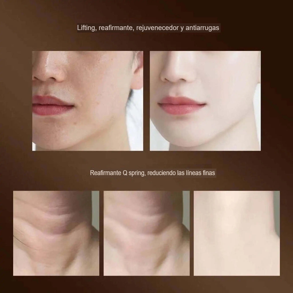 MASAGEADOR FACIAL DE ESTIRAMIENTO 3 EN 1